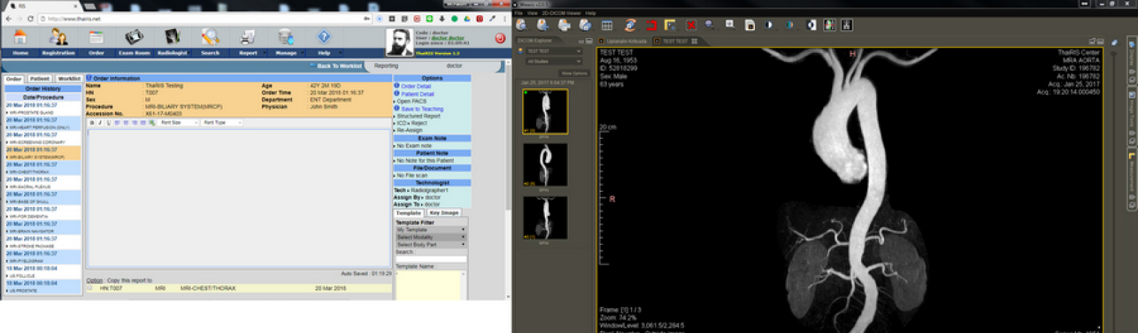 weasis Viewer