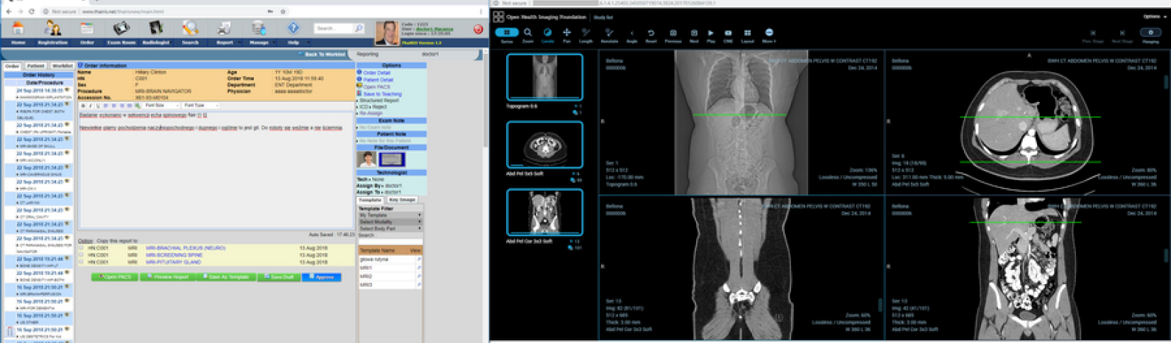 Ohif Viewer