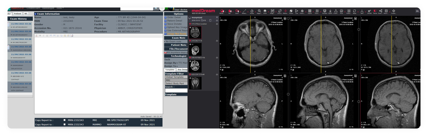 MedDream Viewer